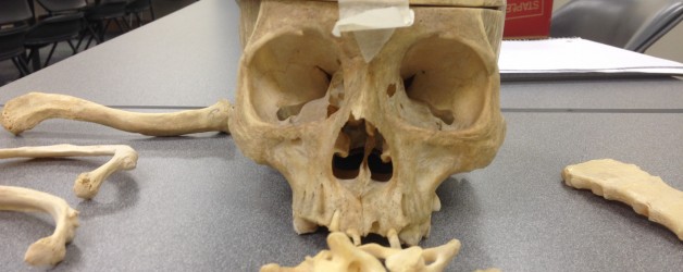 Bone Boot Camp: Week 1 Summary Bone Boot Camp: Week 1 Summary